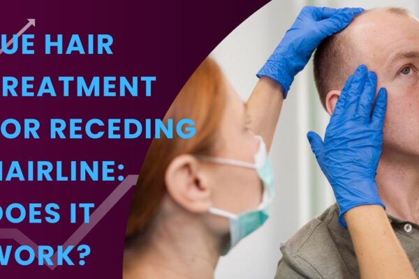 FUE Hair Treatment for Receding Hairline: Does It Work?